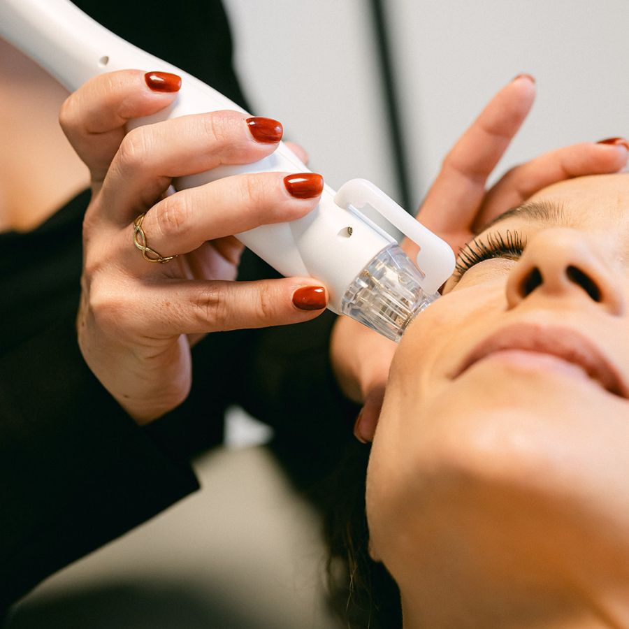 microneedling à la crau dans le var